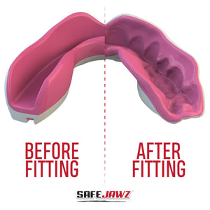 JUNIOR EXTRO SERIES SELF-FIT MOUTHGUARD